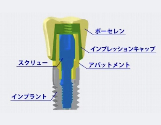 ザクト・システムとは？